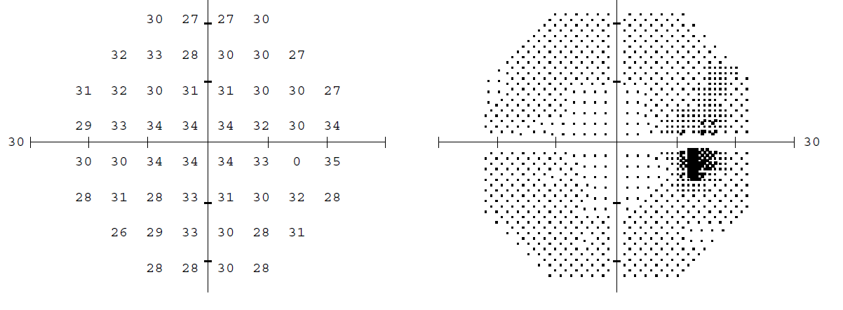 Minimum perceived intensities (in dB)