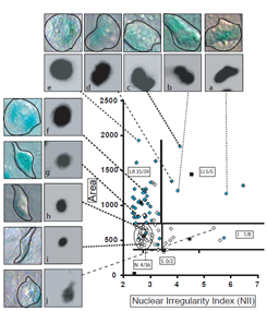 Nuclear Irregularity Index